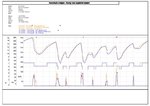 Lisowski vs Dudek - Poznań 7.pdf